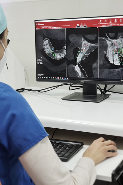 Clínica Go dental, especialistas en implantología